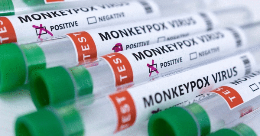 Another Gulf Traveller Hospitalized in Islamabad for Mpox Testing
