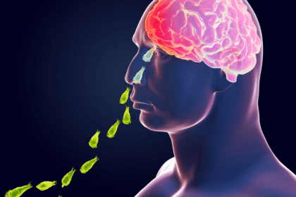 Can-Karachi-Overcome-the-Naegleria-Threat